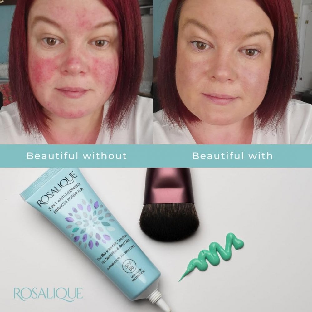 3 in 1 Anti-Redness Miracle Formula SPF50