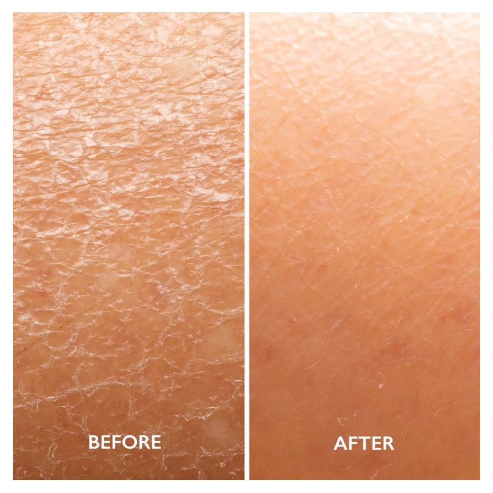 AHA Body Lotion