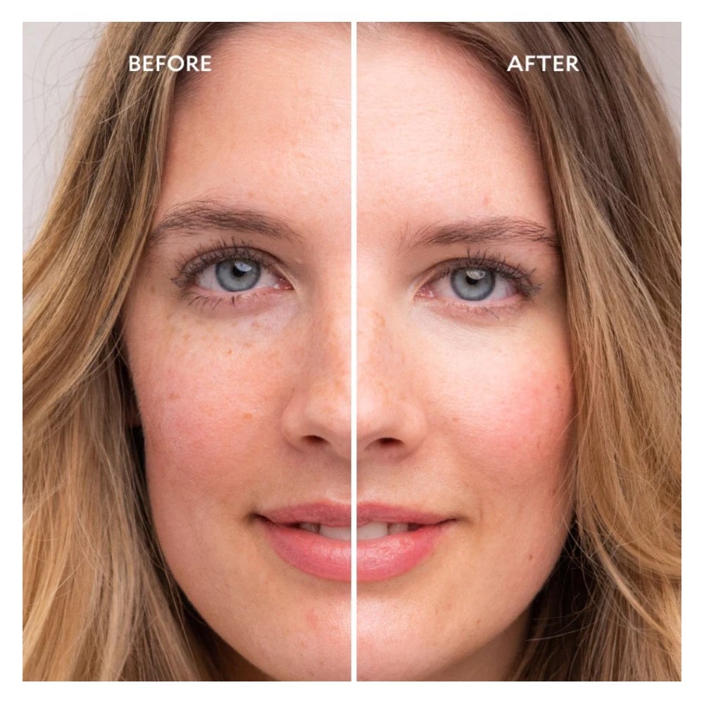 Perfection Ultime Miracle Eye Contour Cream