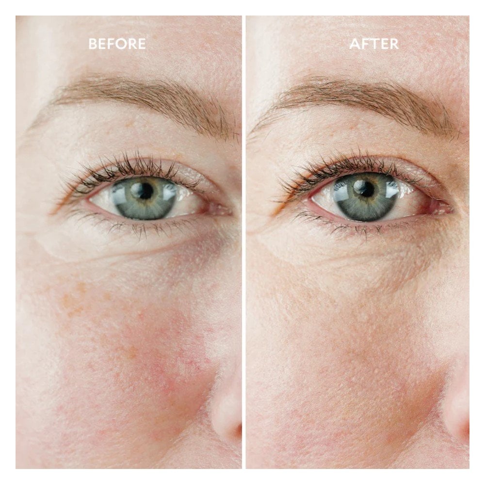 Perfection Ultime Miracle Eye Contour Cream