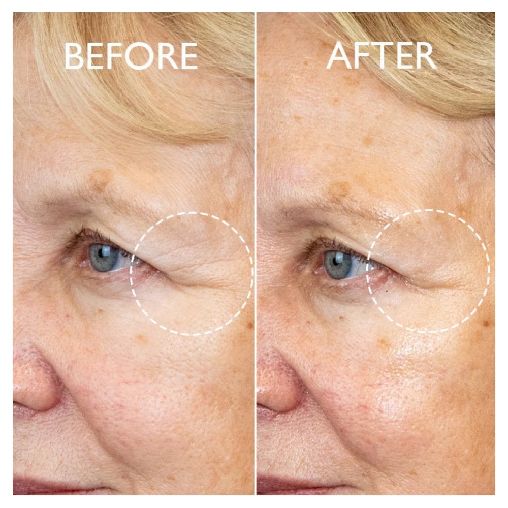 Defi Lift Firming Eye Contour Serum