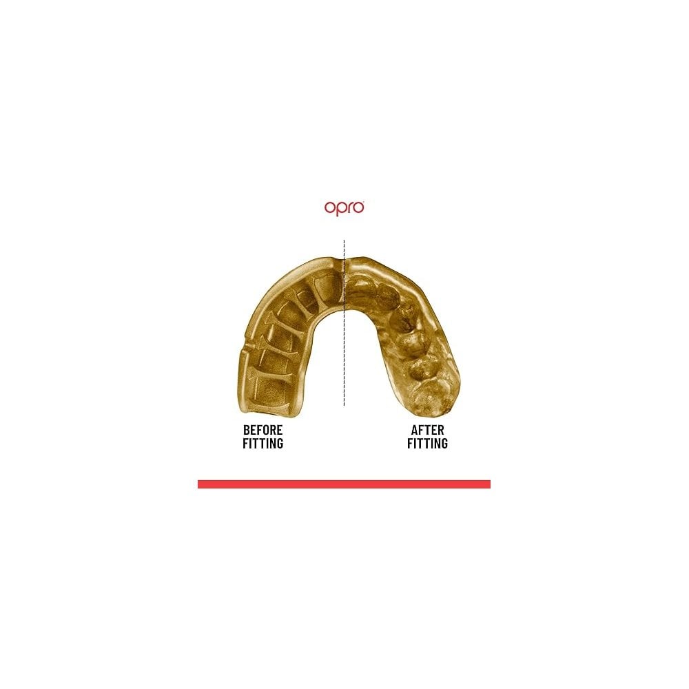 OPRO Gold Self-Fit Mouthguard