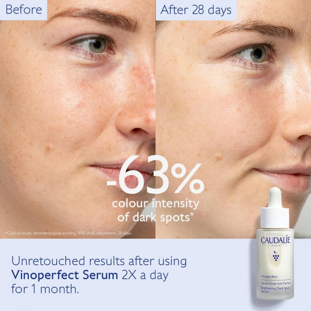 Vinoperfect Dark Spot Brightening Serum Vitamin C Alternative