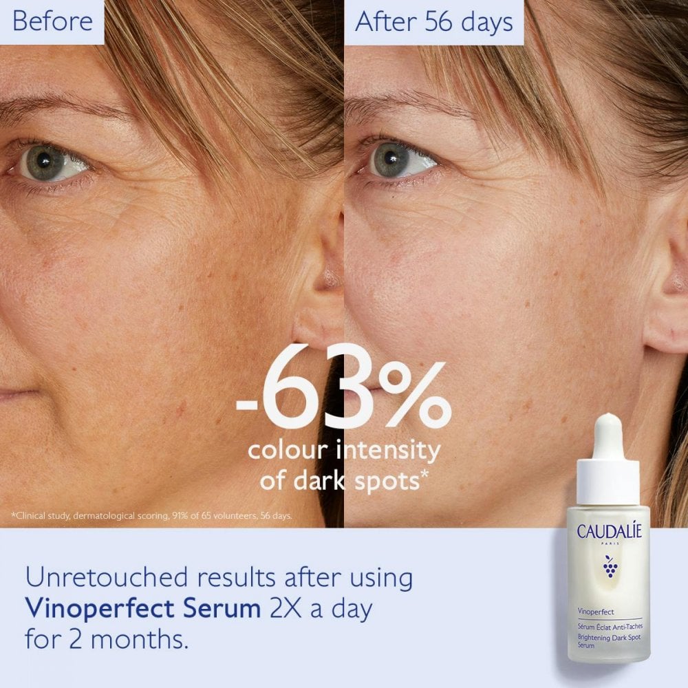 Vinoperfect Dark Spot Brightening Serum Vitamin C Alternative