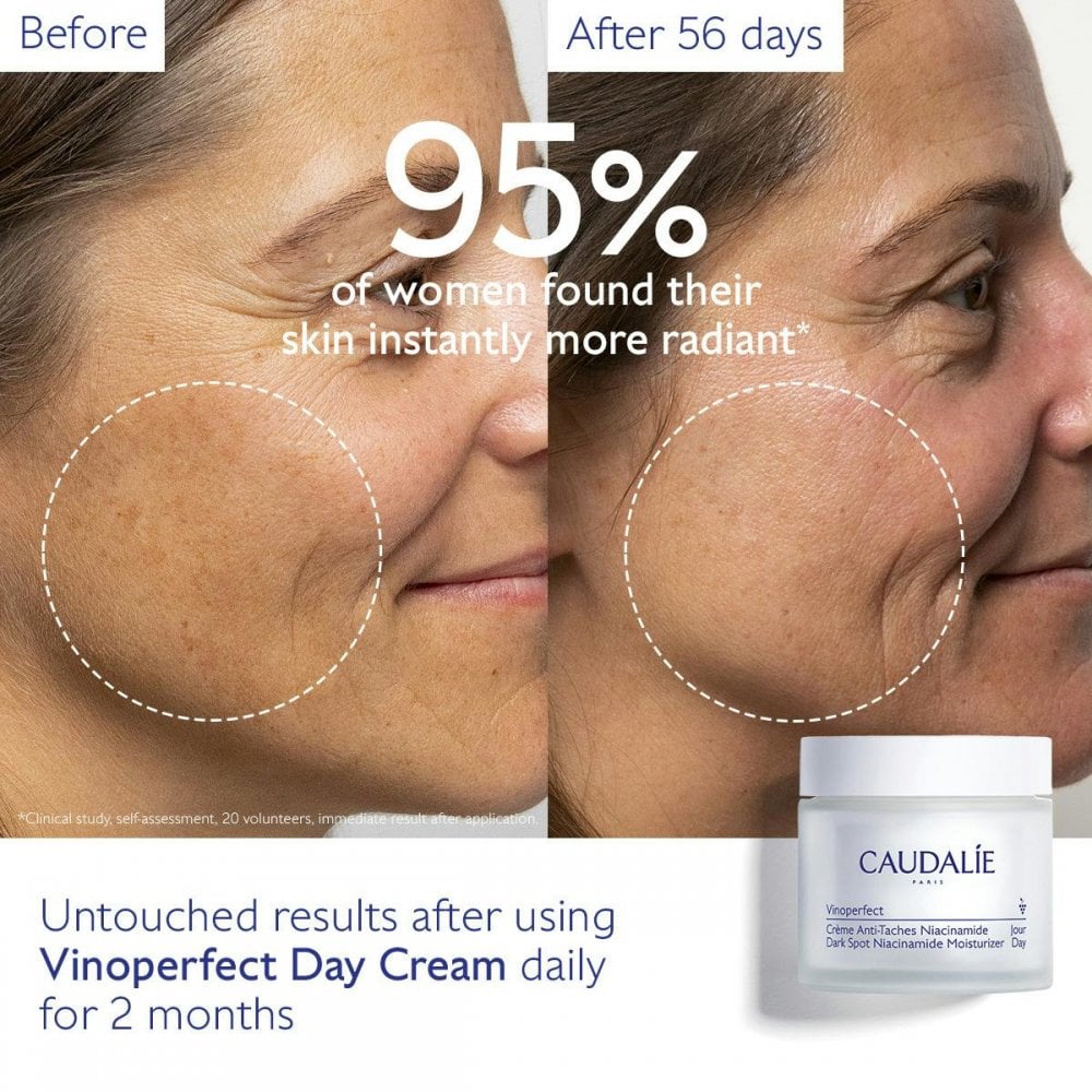 Dark Spot Niacinamide Moisturizer Refill
