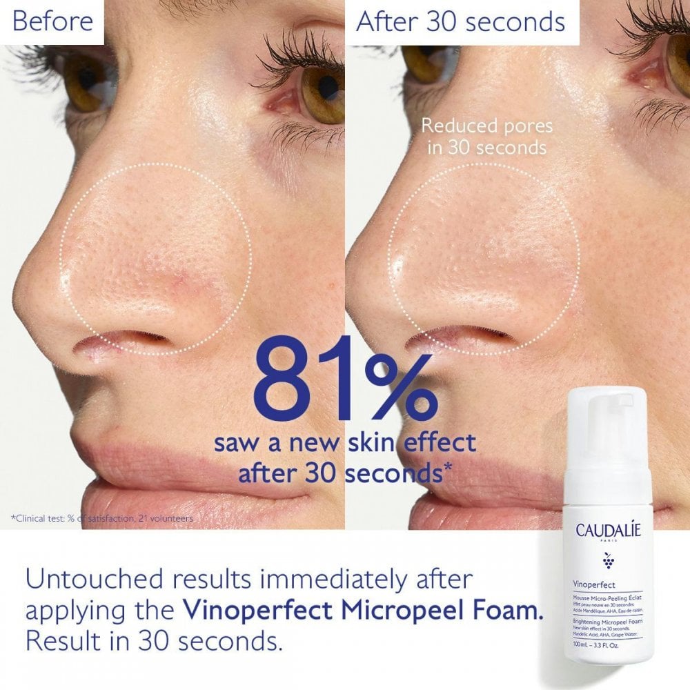 Vinoperfect Brightening AHA Micropeel - 50ml