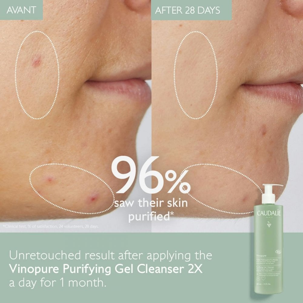 Vinopure Purifying Gel Cleanser - 385 mL