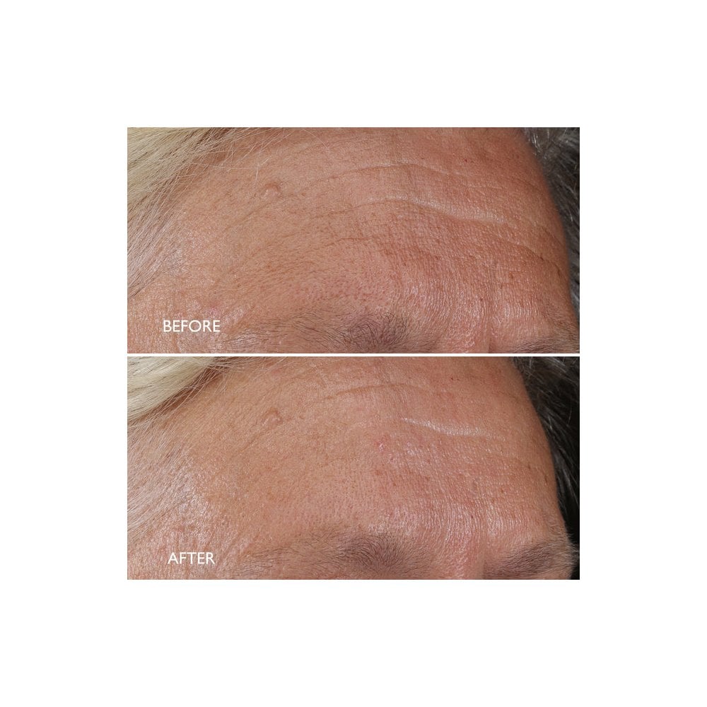 Age Benefit™ Night Renewal Cream