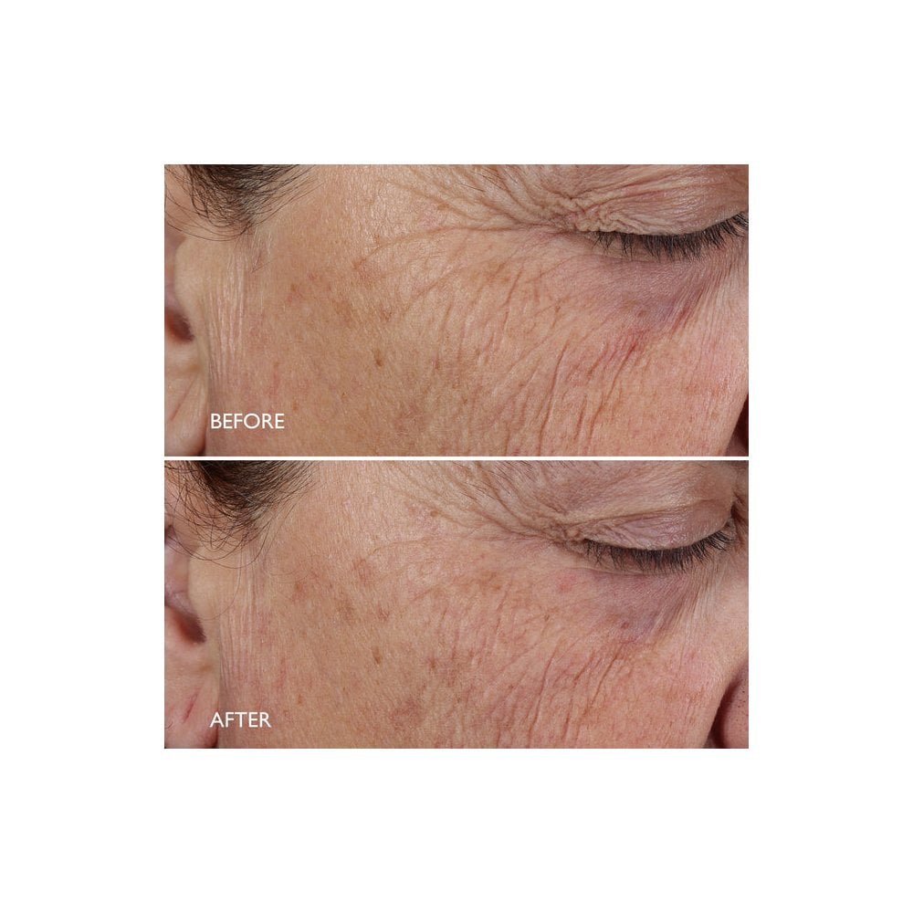Age Benefit™ Night Renewal Cream